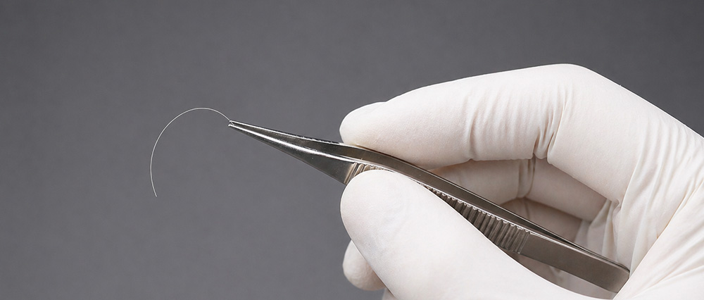 Stitch removal