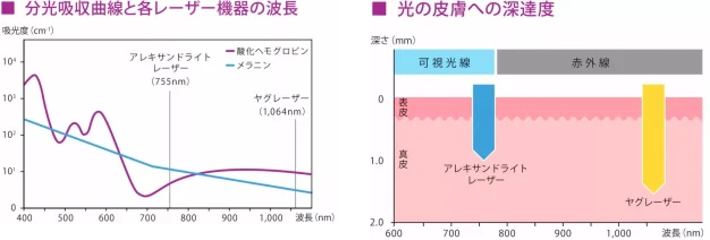 ジェントルシリーズ徹底解説 