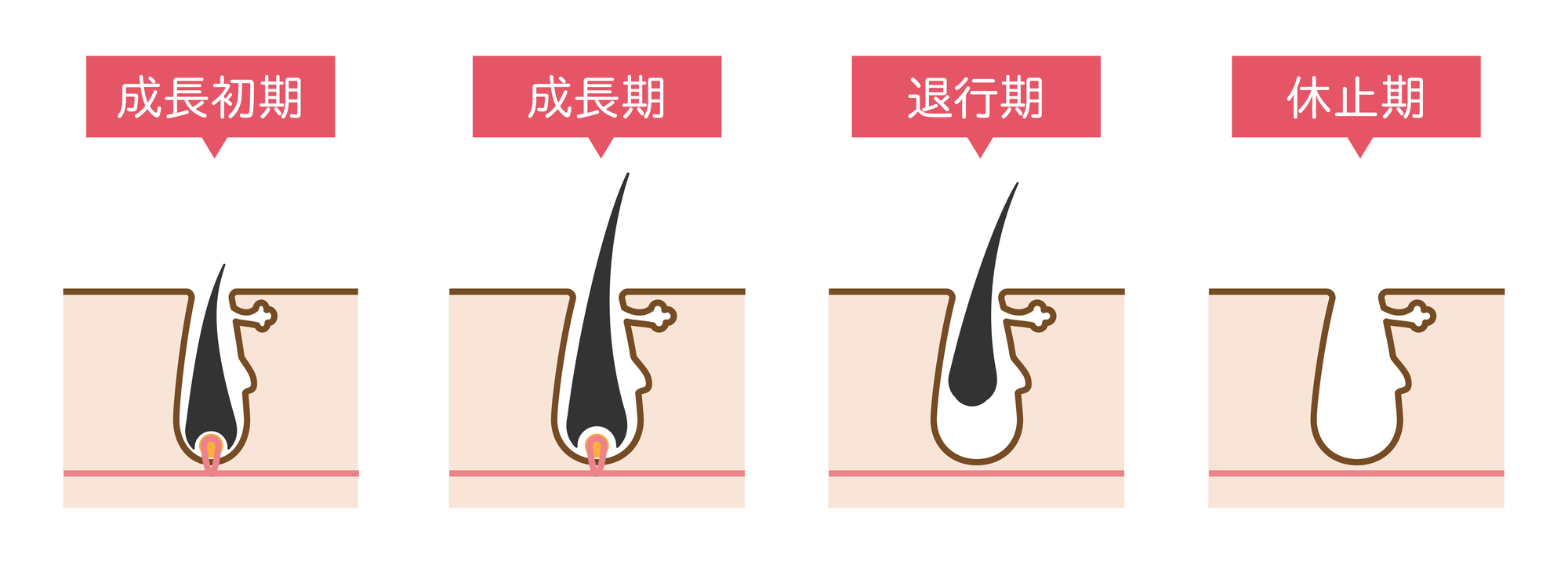 【部位別】医療脱毛は何回で効果が出る？　脱毛効果を感じにくい際の対処法も解説- 医療脱毛ならカノアクリニック
