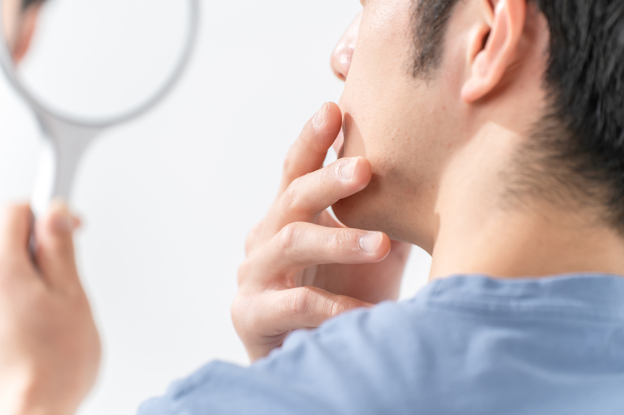 髭脱毛後のスキンケアはなぜ必要？　正しいケア方法や注意点を解説ー福岡・沖縄の医療脱毛ならKANNO'A.clinic(カノアクリニック)