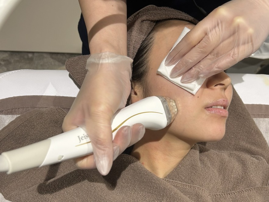 ポテンツァの効果を徹底解説！いつから、何回で実感できる？肌悩み別・最新美容医療の全貌ー福岡・沖縄の医療脱毛ならKANNO'A.clinic(カノアクリニック)