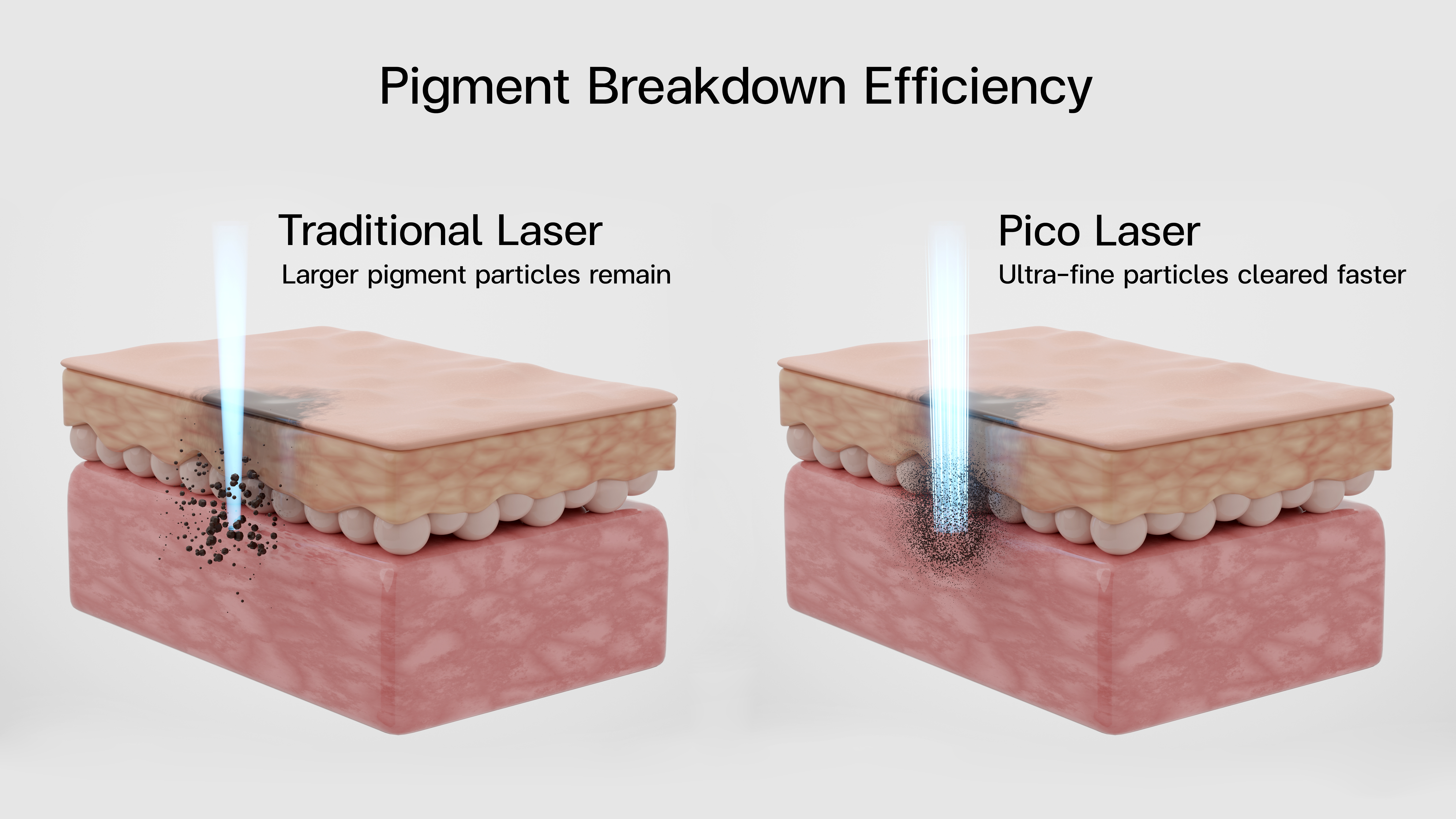 ピコトーニングの効果とは？シミ・くすみ・毛穴への作用を徹底解説ー福岡・沖縄の医療脱毛ならKANNO'A.clinic(カノアクリニック)