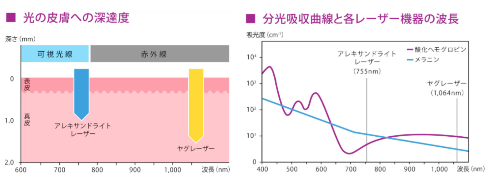 ジェントルマックスプロプラスとジェントルマックスプロの違いは？選び方までわかりやすく解説ー福岡・沖縄の医療脱毛ならKANNO'A.clinic(カノアクリニック)